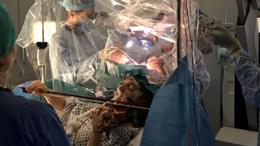 Video: tocó el violín mientras la operaban para extraerle un tumor cerebral