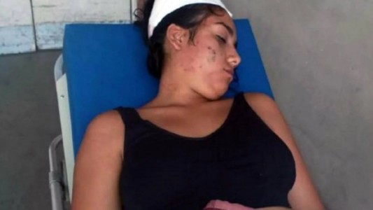 Rosario: una chica está internada tras ser atacada en manada a la salida de un boliche