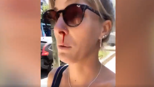 Golpearon y lastimaron a la instagramer Dani La Chepi para robarle el teléfono