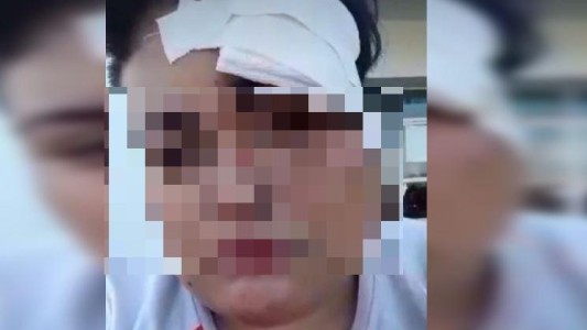 Ataque lesbofóbico: una mujer fue golpeada a la salida de un boliche por cinco hombres