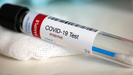 En la provincia hay 21 casos positivos de coronavirus y 69 en estudio