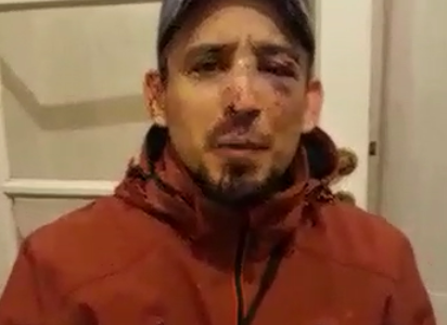 Sacó a pasear a su perro a la noche y la policía lo "molió a golpes"