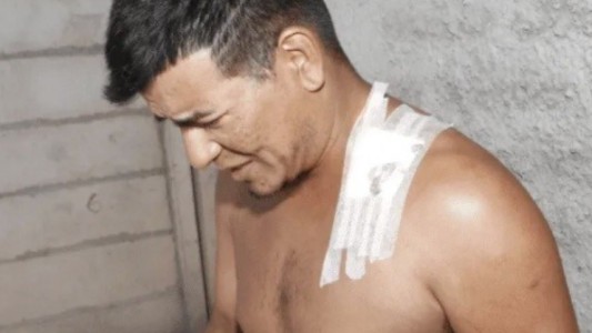 Lo apuñaló su novia y a las pocas horas la perdonó: "acá, con mi tóxica..."