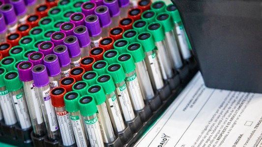 Desde CUDAIO explicaron que el tratamiento con plasma “no es una vacuna”