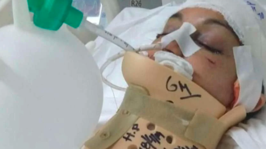 El calvario de Fátima: su ex pareja la dejó en coma y ahora pidió la domiciliaria en su casa