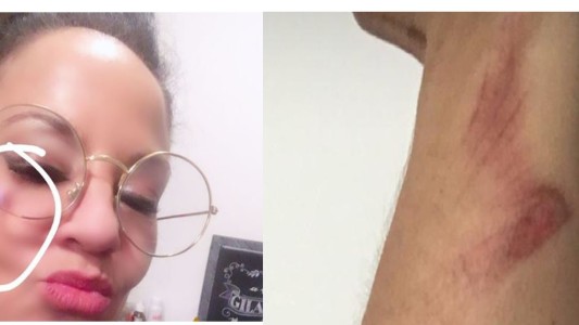 Miss Bolivia apuntó en redes sociales a su ex por violencia de género