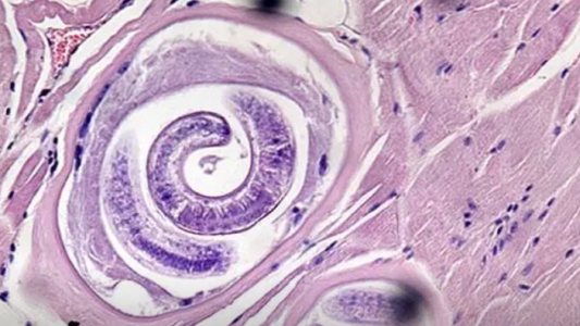 Triquinosis: más de 50 casos en Nelson y se analizan una decena en Paiva