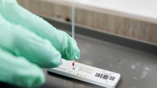 El test serológico argentino para COVID-19 llegó a los 100.000 ensayos