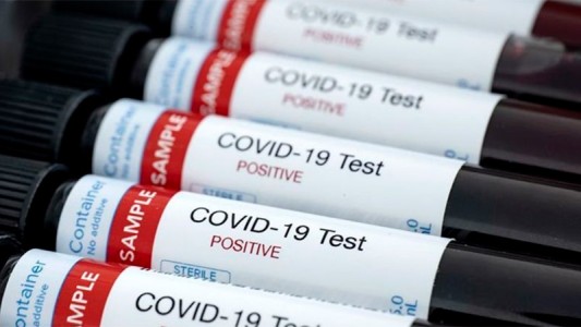 Se registraron 10 nuevos casos de coronavirus: 9 se sumaron en Paraná