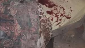 Coronda: le arrancó la oreja a su novia de un mordiscón