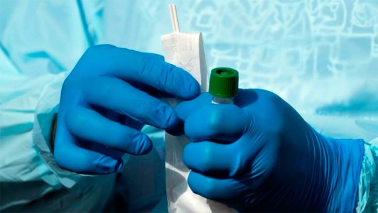 Este sábado reportan 31 nuevos casos de coronavirus: 20 son en Paraná