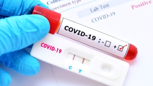 Detectaron 13 nuevos casos de COVID-19 en Entre Ríos: Nueve fueron en Paraná