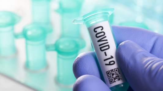 Reportan 24 nuevos casos de COVID-19 en Entre Ríos: 12 en el departamento Paraná