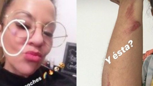 La Justicia archivó la denuncia de Miss Bolivia por violencia de género contra su ex