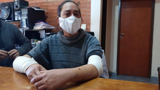 Feroz ataque de cinco perros a una mujer: “el casco de la moto le salvó la vida”