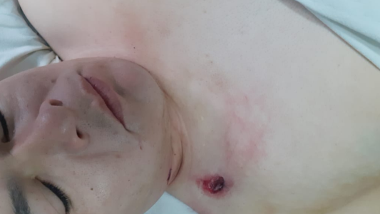 Robaron y le dispararon tres veces a un remisero en el norte de la ciudad