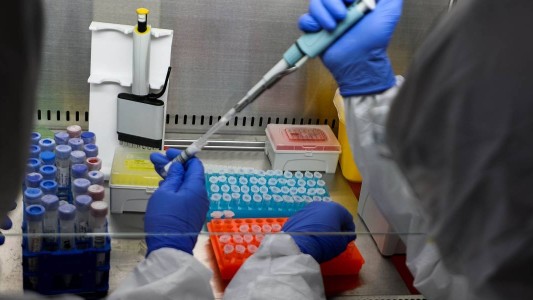 Argentina fabricará la vacuna de Oxford contra el coronavirus