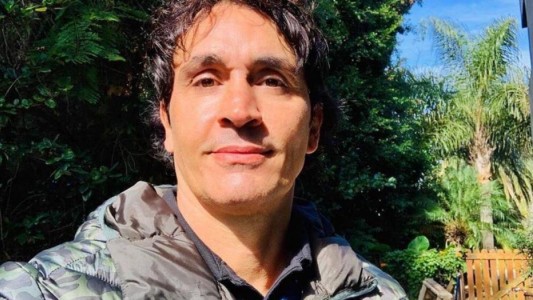 Sebastián Estevanez mostró como le quedó la cara luego de un accidente doméstico