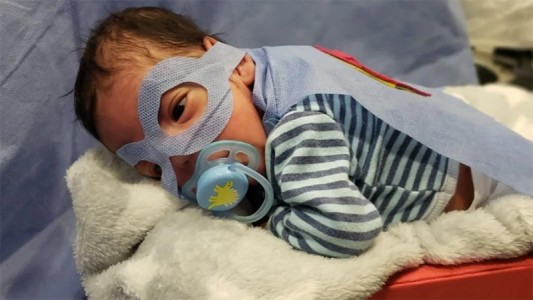 Superbebé: Pesó 500 gramos al nacer y logró el alta tras casi 100 días de internación