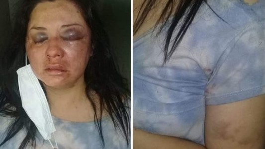 Tucumán: una mujer se escapó del hospital por miedo a que su marido la mate