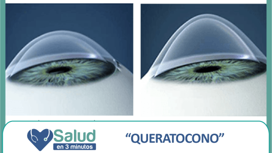 El queratocono afecta a más de 20.000 argentinos: ¿qué es y cómo puede tratarse?