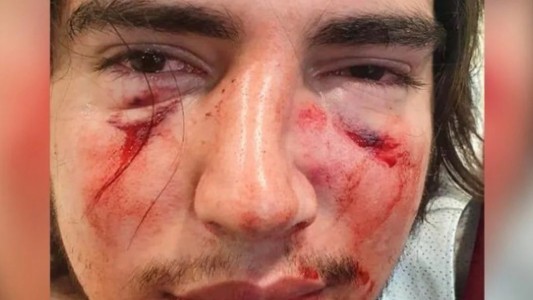 Denuncian un brutal ataque de rugbiers contra un joven de 18 años