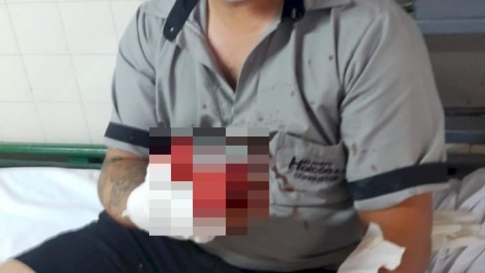 Acusó a un colectivero por una infidelidad y le amputó el dedo