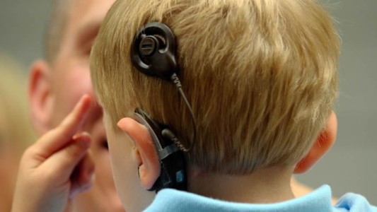 Día del Implante Coclear: cómo detectar la hipoacusia de forma temprana