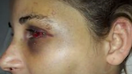 Intento de femicidio en San Carlos Centro: "Florencia está devastada psicológicamente"