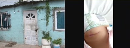 Balearon a su beba de un año hace 2 meses, tiene el alta pero no quiere volver a su casa