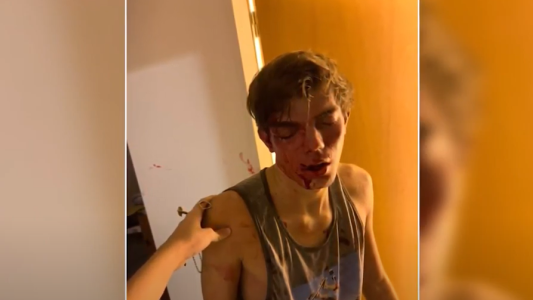 Eran conocidos, le robaron la llave y entraron a robar: le desfiguraron la cara a su amigo