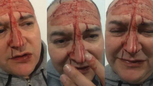 El video del brutal ataque a Leo García