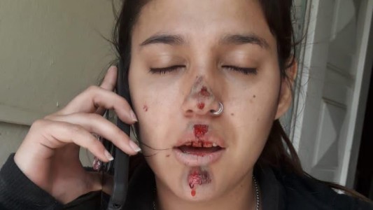 Asalto y brutal golpiza a una joven en Guadalupe Oeste