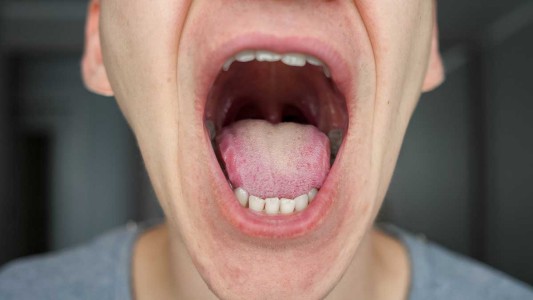Comenzó la campaña "Hablemos de cáncer bucal" en la Costanera Oeste