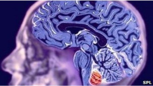 Científicos argentinos convierten células de la piel en neuronas para estudiar un tipo de epilepsia
