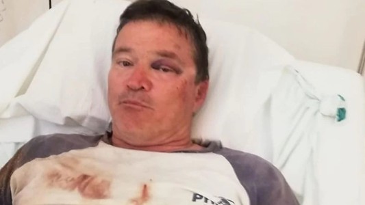 Torturan a un productor rural en Venado Tuerto para robarle