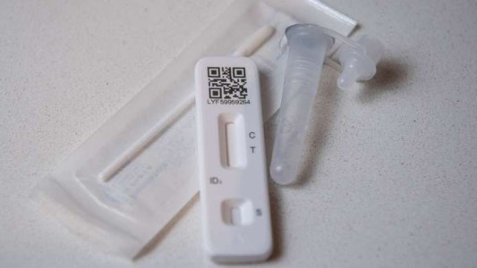 Estiman que los autotest para Covid-19 estarán a la venta en farmacias en enero