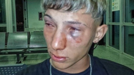 Un grupo de patovicas le dio una brutal golpiza a un joven en la zona de la ruta 168