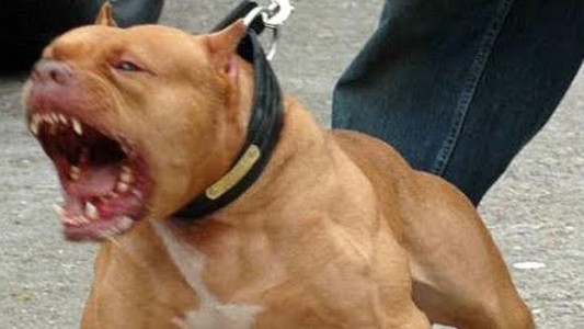 Se peleaban los perros pitbull de su novio, quiso separarlos y terminó internada con graves heridas
