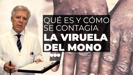 Viruela del mono: ¿Qué es y cómo se transmite?