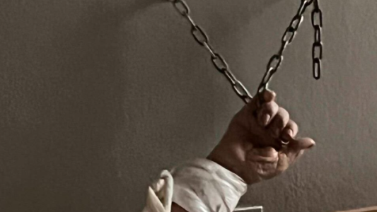 Imágenes sensibles: encuentran a un hombre de 81 años encadenado en un sanatorio