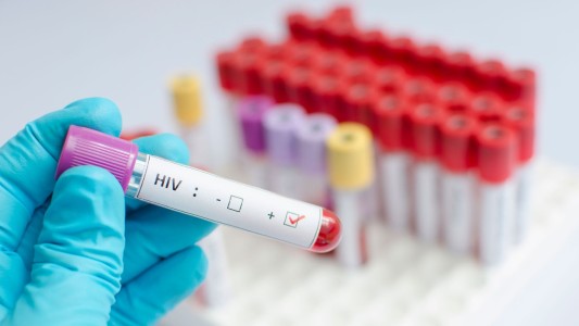 Cipress realiza test rápidos de Sífilis y VIH ante el aumento de casos