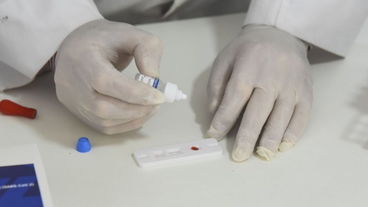Hubo 2.935 contagios de coronavirus en el país