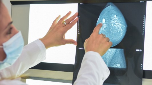 Mes de concientización sobre el cáncer de mama: El Cemafe suma turnos para mamografías