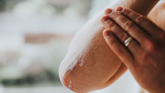 Día Mundial de la Psoriasis: hoy realizaron un cruce del puente para su visibilización