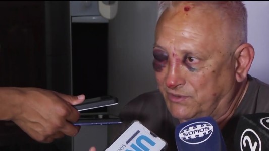 Delincuentes asaltaron y golpearon a un matrimonio en Arroyo Leyes