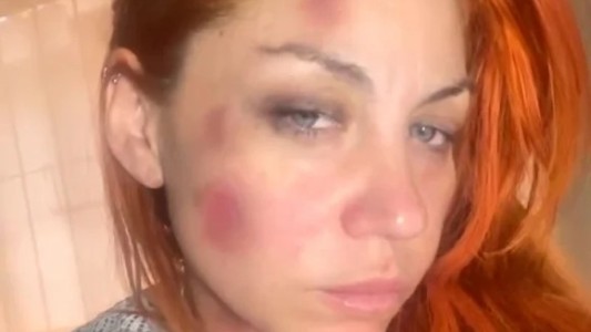 Lowrdez Fernández acusó a su novio de violencia de género