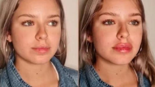 Coti de Gran Hermano se hizo un retoque estético y mostró el resultado