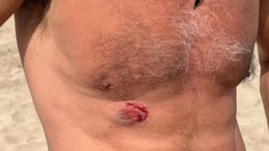 Denunció que fue mordido por un vendedor ambulante y tuvo un final inesperado