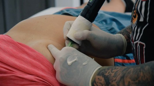 Tatuajes Sanadores Solidarios: Para mujeres que por una mastectomía requieren la intervención de sus aureolas